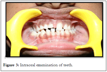 Essences-Dentistry-Intraoral
