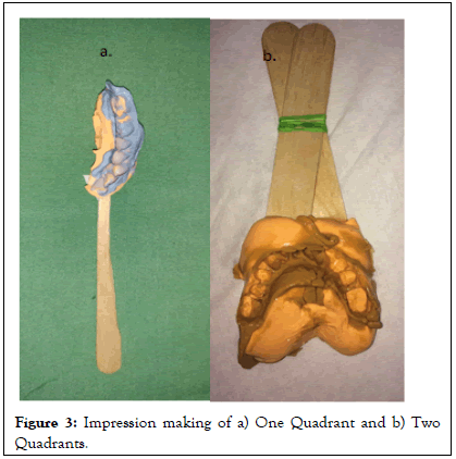 Essences-Dentistry-Quadrant