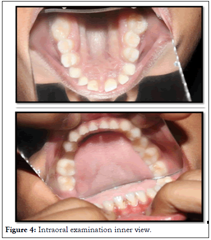 Essences-Dentistry-examination