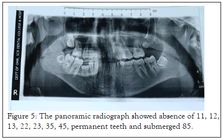 Essences-Dentistry-panoramic