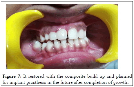 Essences-Dentistry-prosthesis