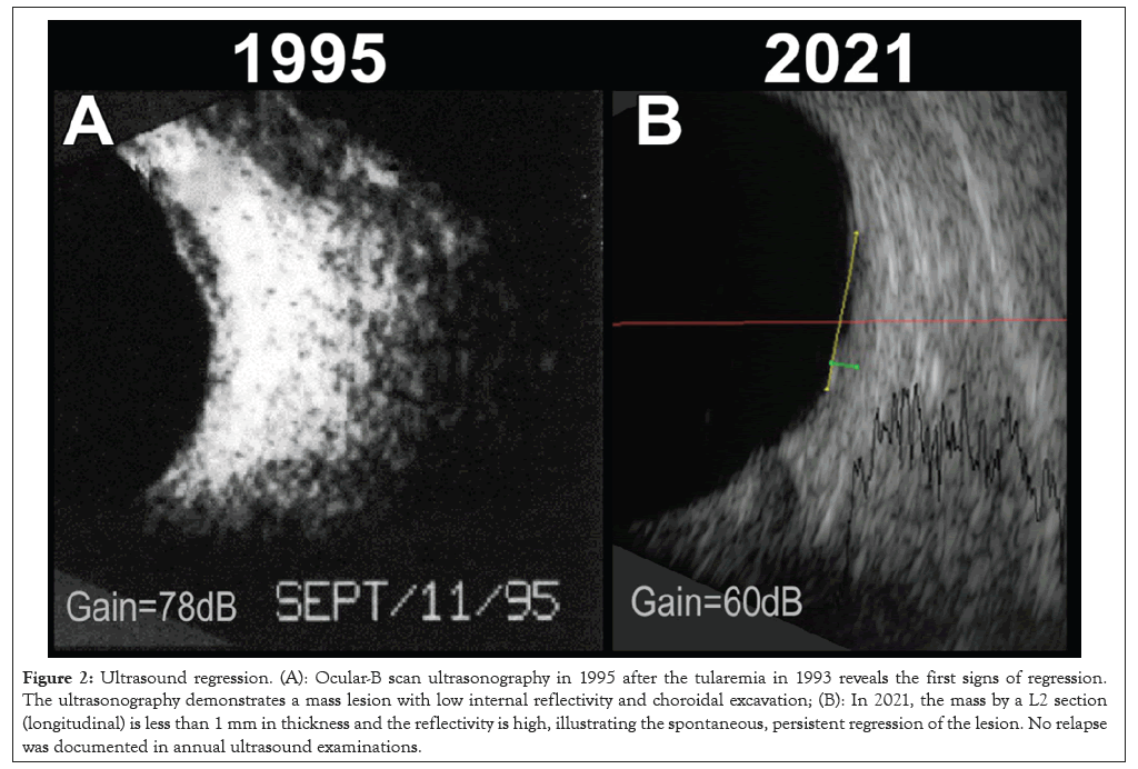 Ultrasound