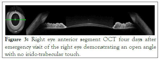 anterior