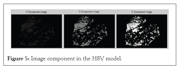 component