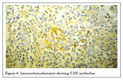 antibodies