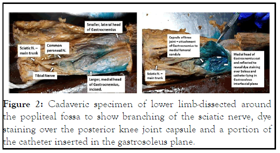 JACR-lower