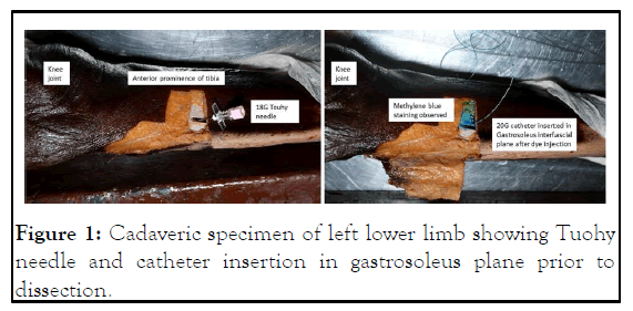 JACR-specimen