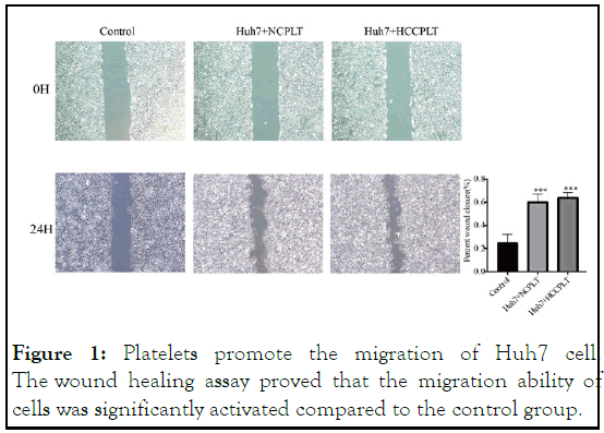 JCCLM-Platelets