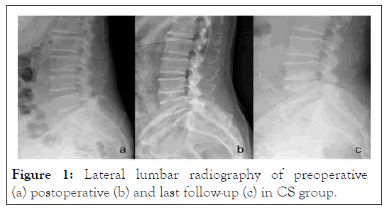 JCTR-Lateral