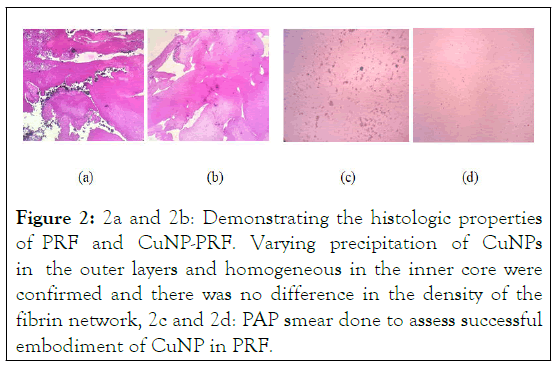 JMPB-histologic