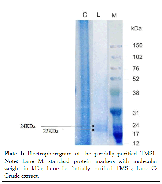 Electrophoregram