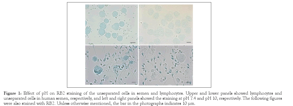 Medical-Diagnostic-Methods-lymphocytes