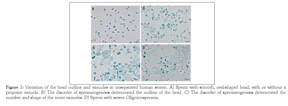 Medical-Diagnostic-Methods-vacuoles