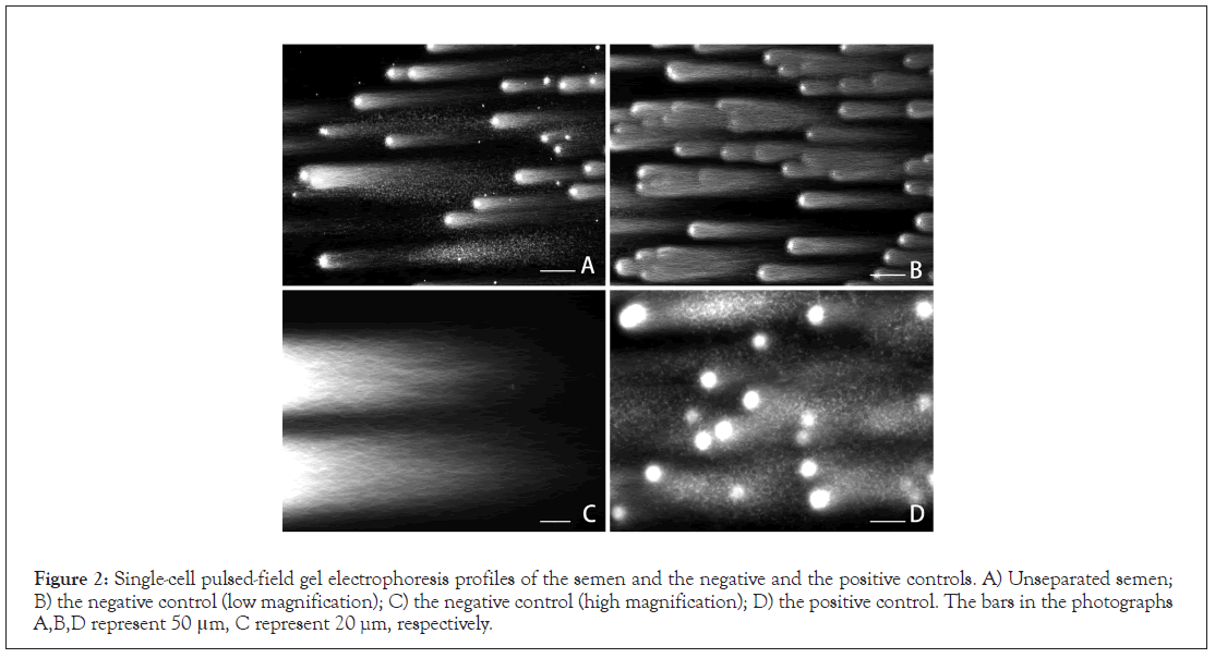 Medical-electrophoresis