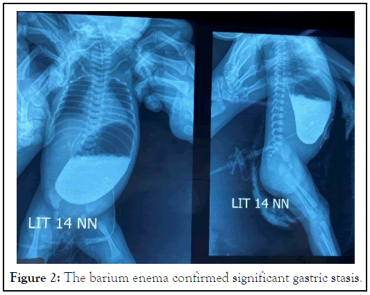 barium