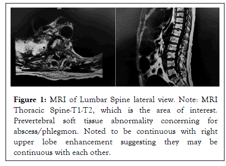 Physical-Medicine-Spine