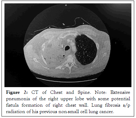 Physical-Medicine-cancer