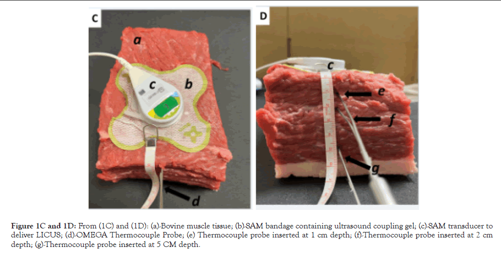 Physical-Medicine-muscle