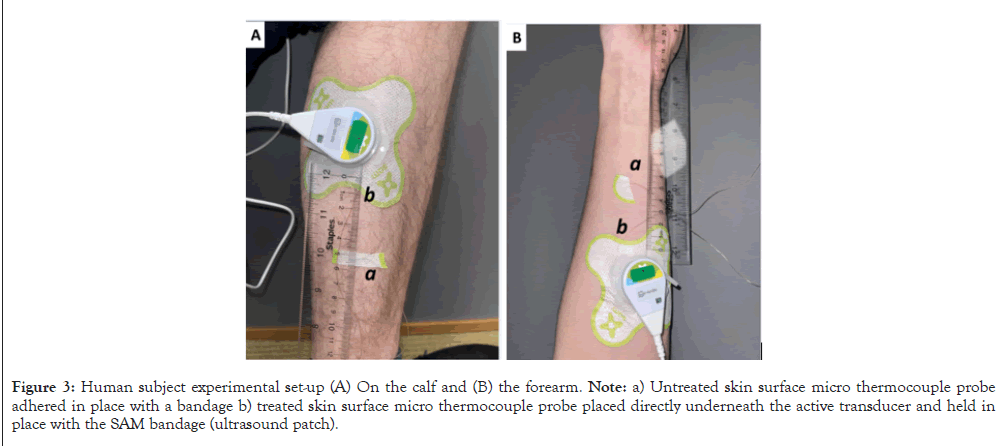 Physical-Medicine-thermocouple