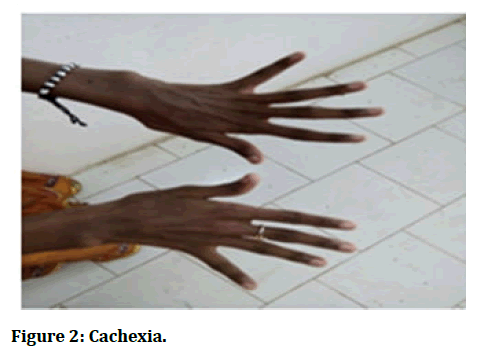 Research-Dental-Cachexia