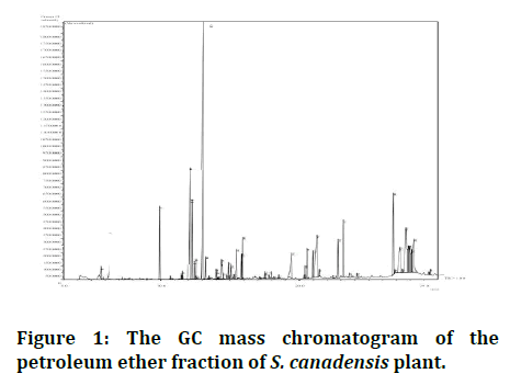 Research-Dental-chromatogram