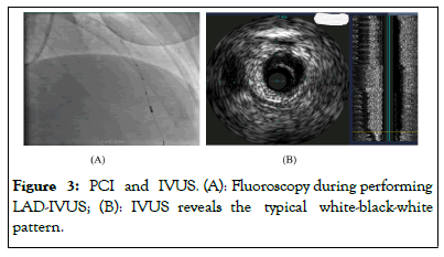 Fluoroscopy