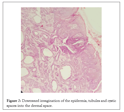 epidermis