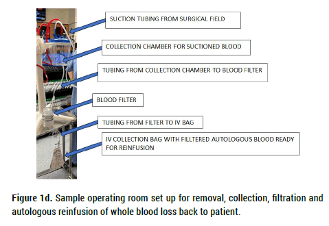 biology-reinfusion