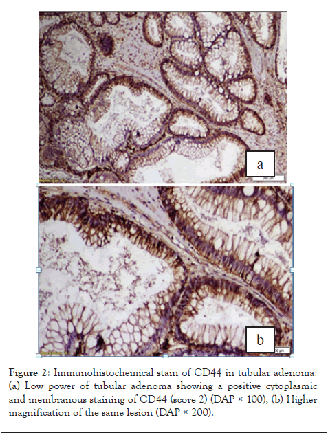 cancer-science-research-tubular