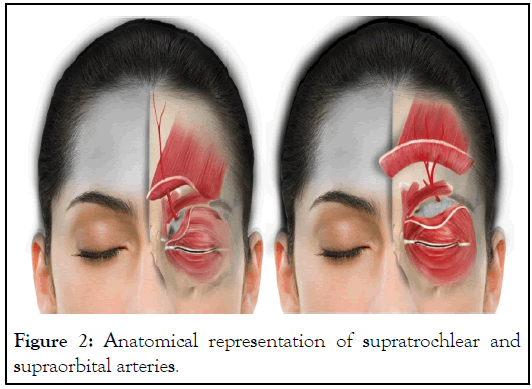 Anatomical