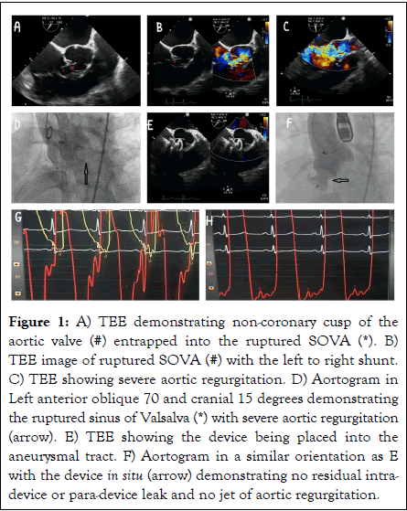 cardiology