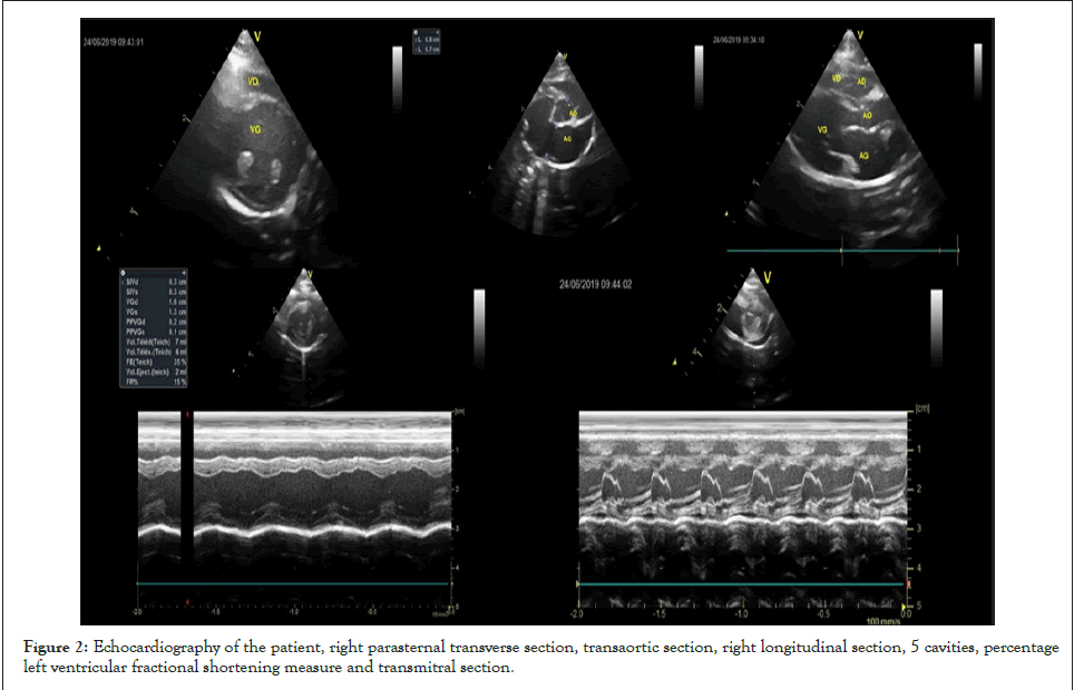 clinical-experimental-cardiology-transaortic