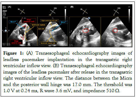 clinical-experimental-cardiology-transgastric