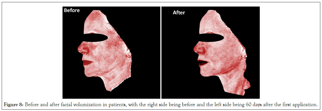 volumization