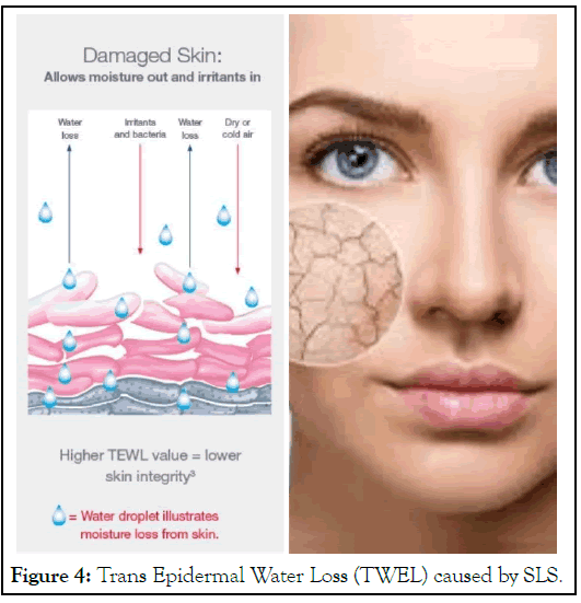 Sodium Lauryl Sulfate Uses, SLS Full Form