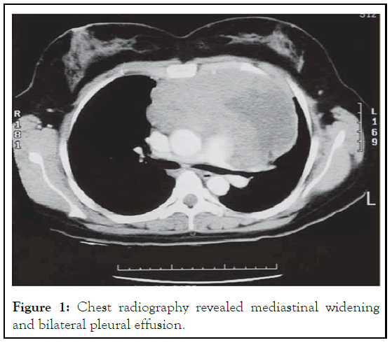 egm-Chest