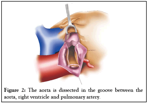 experimental-cardiology-pulmonary