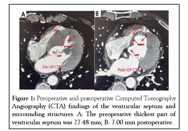 experimental-cardiology-ventricular