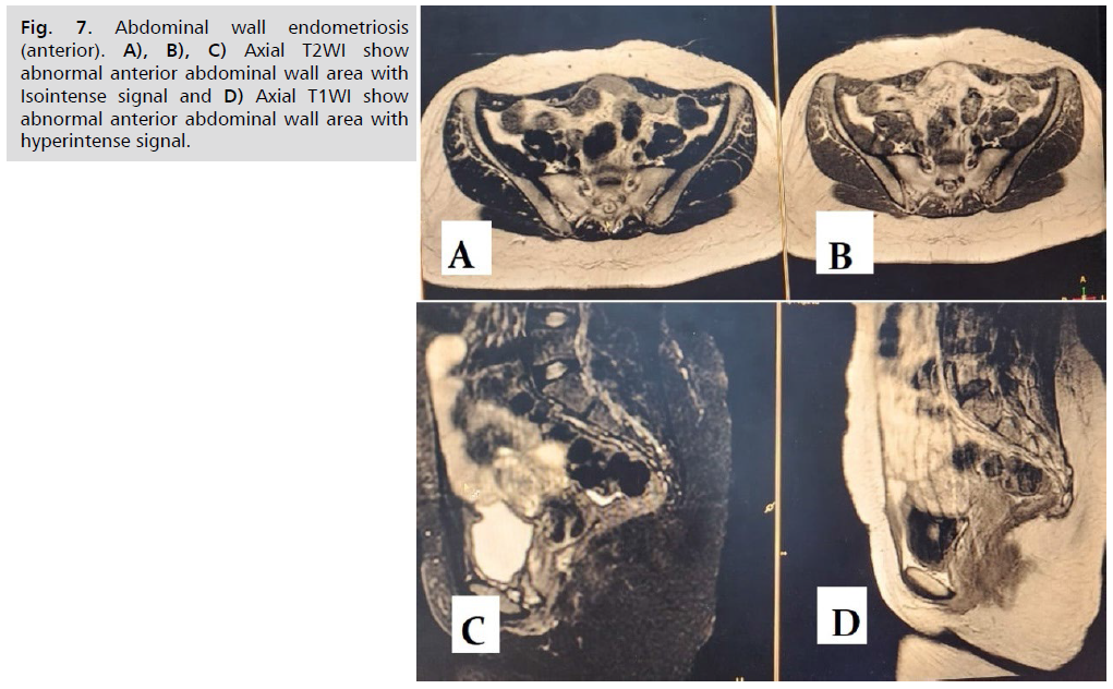 ginekologia-abdominal