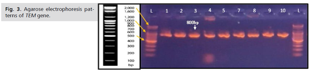 ginekologia-electrophoresis