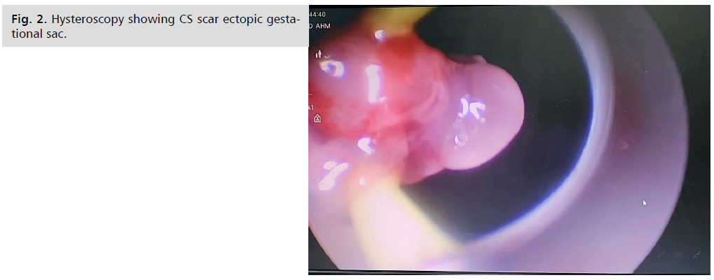 ginekologia-hysteroscopy