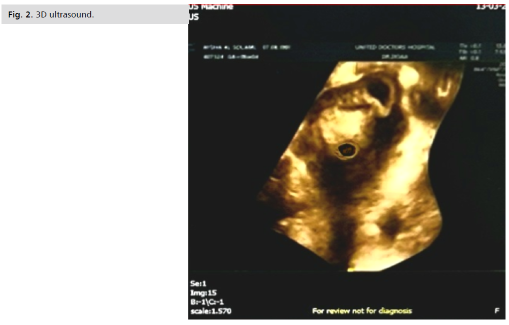 ginekologia-ultrasound