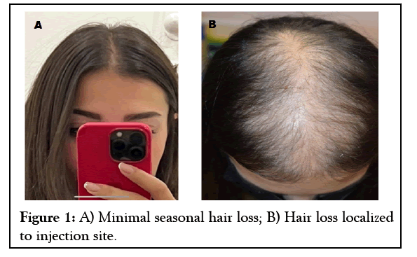 hair-therapy-hair
