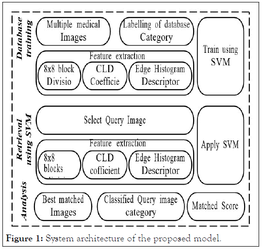 ime-System