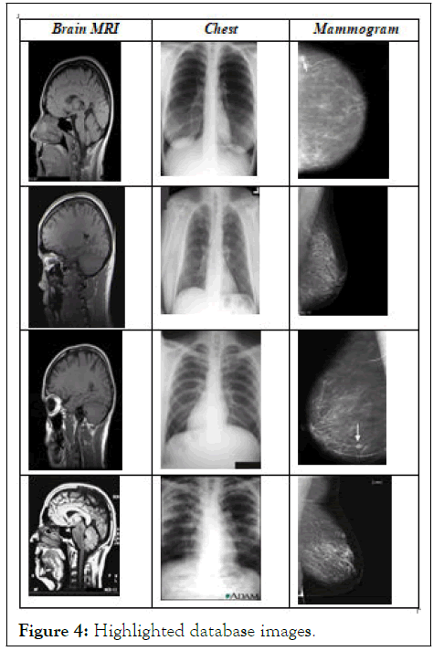 ime-database