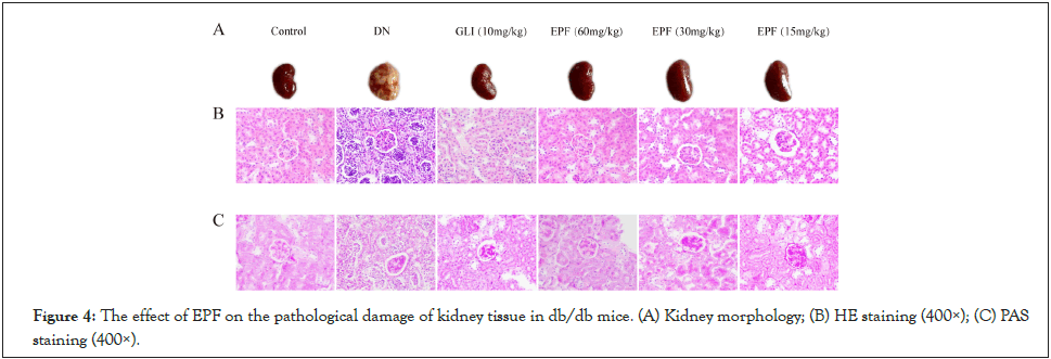 internal-medicine-kidney