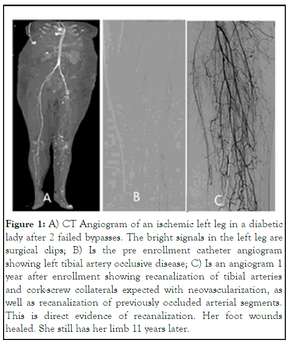 jcest-Angiogram