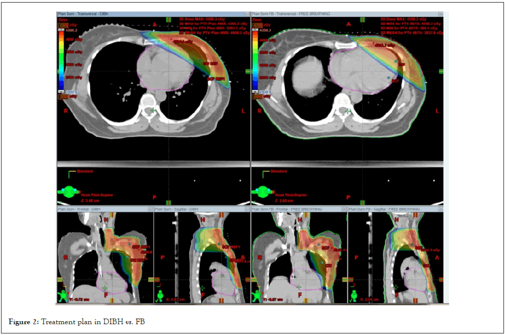 journal-cancer-plan