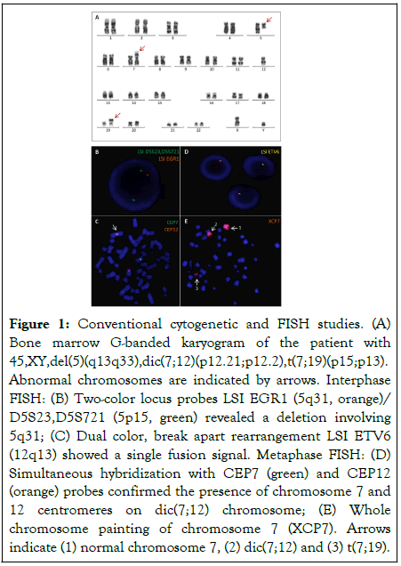 journal-leukemia-bone