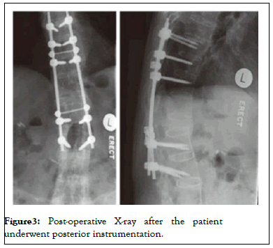 muscular-system-instrumentation